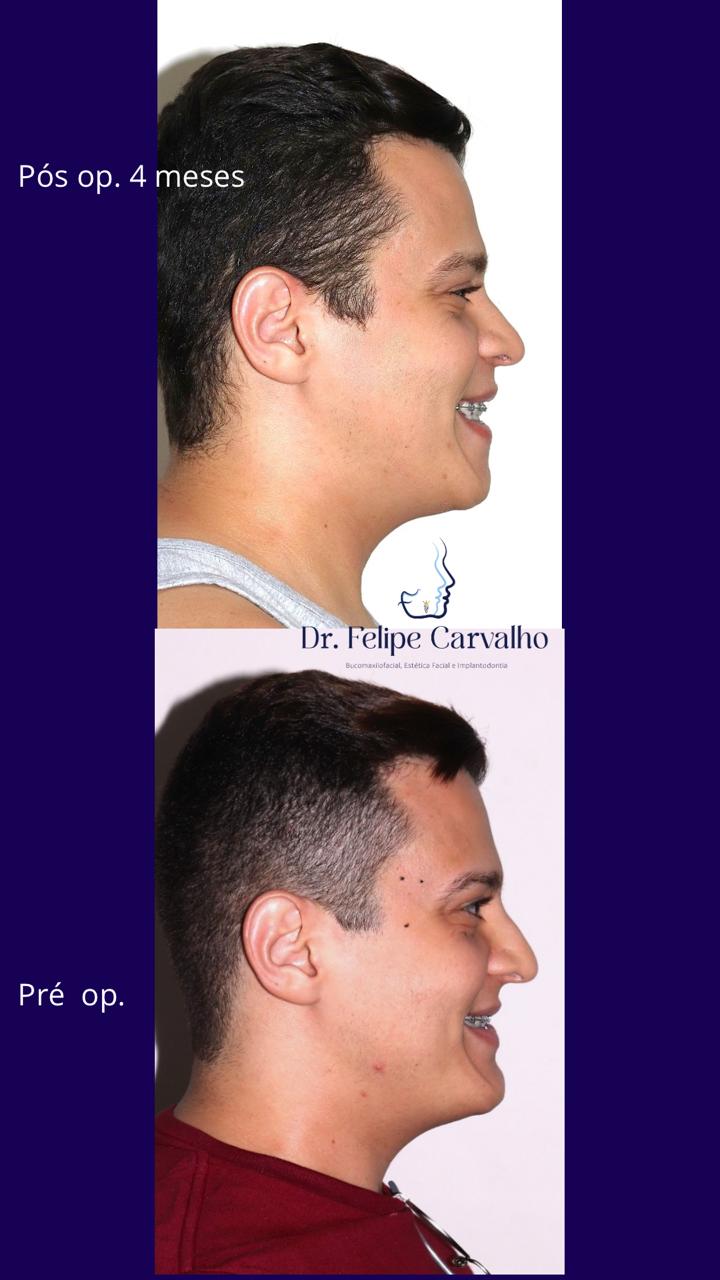 Caso real — Dr. Felipe Carvalho