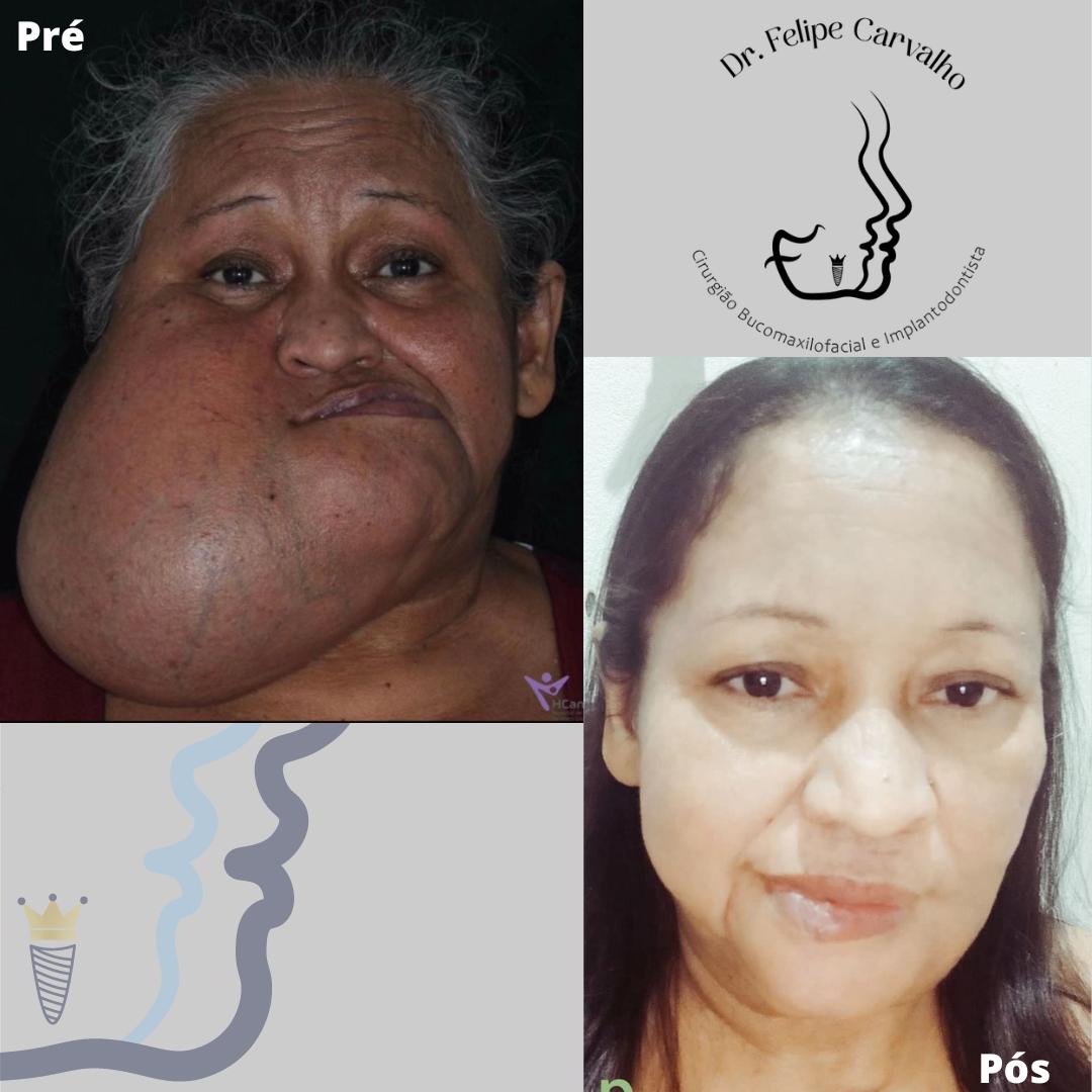 Caso real — Dr. Felipe Carvalho