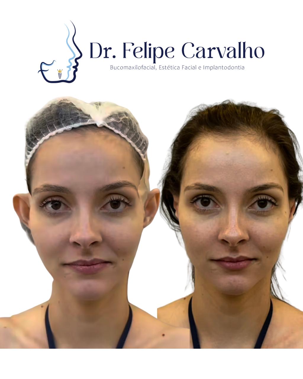 Caso real — Dr. Felipe Carvalho