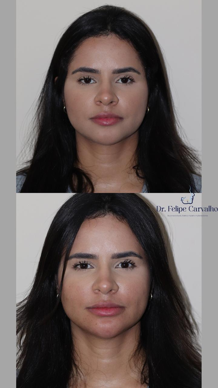 Caso real — Dr. Felipe Carvalho