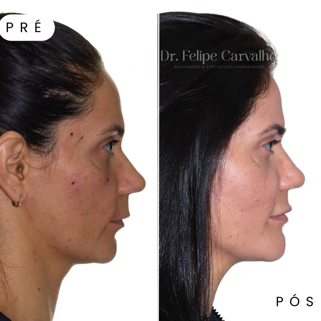 Caso real — Dr. Felipe Carvalho