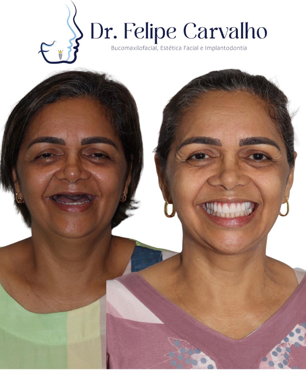 Caso real — Dr. Felipe Carvalho